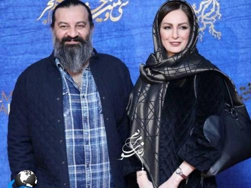 عکس شقایق دهقان قبل و بعد عمل
