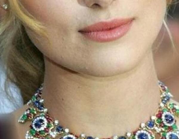 عکس کریشی الماسی