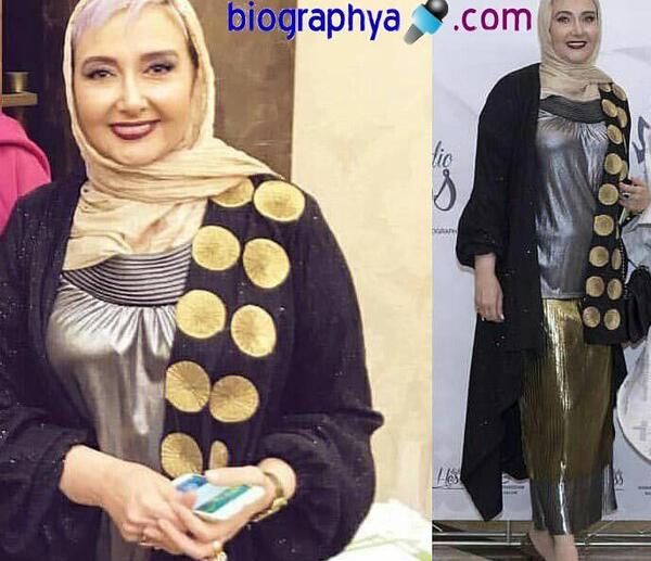 عکس قبل از عمل کتایون ریاحی