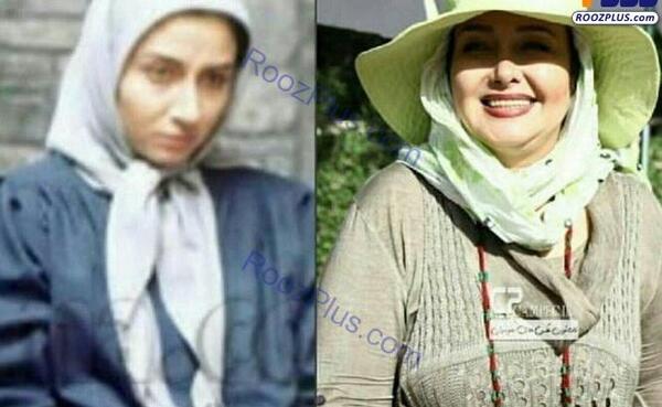 عکس قبل از عمل کتایون ریاحی