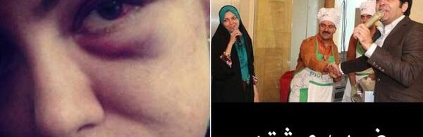 عکس صورت کبود نامداری