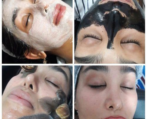 عکس قبل و بعد حلزون تراپی