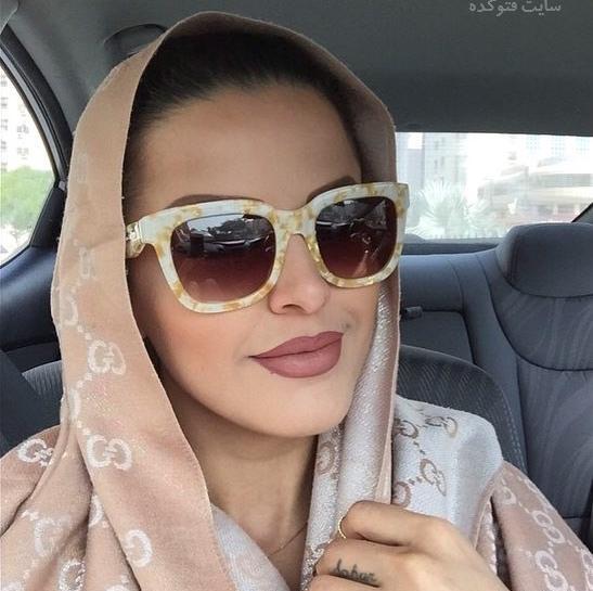 عکس سحر خواننده قبل از عمل