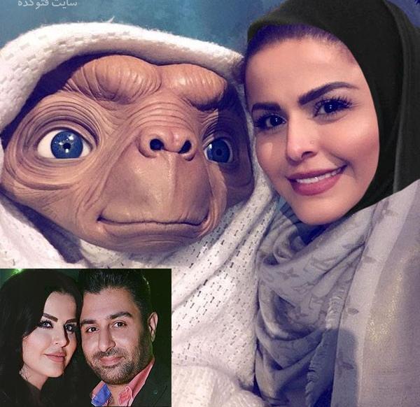 عکس سحر خواننده قبل از عمل