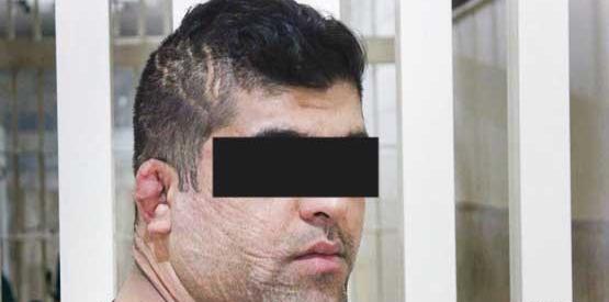 عکس مرد صورت زخمی