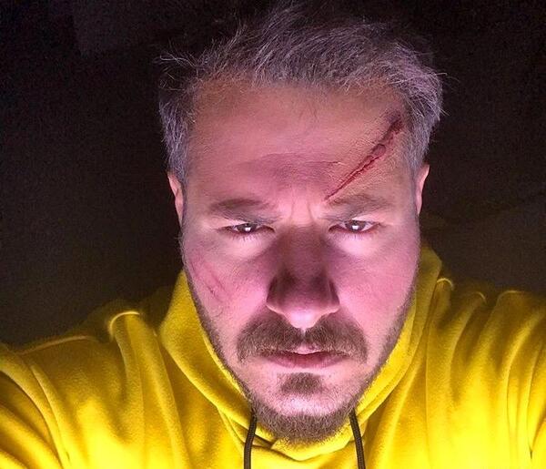 عکس مرد صورت زخمی
