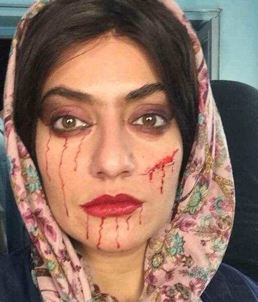 عکس مرد صورت زخمی