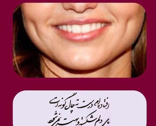 عکس پروف دخترونه چال گونه