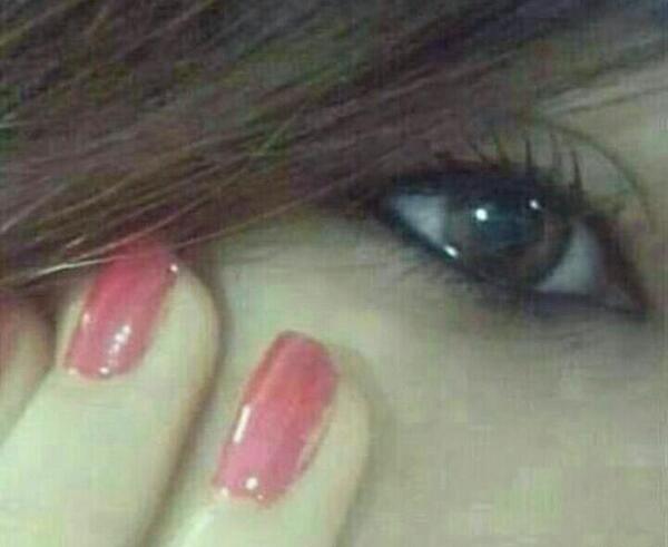 عکس چشم گریه کرده طبیعی