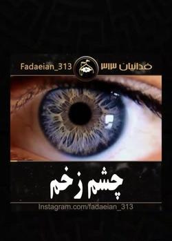 عکس چشم زخم عاشقانه
