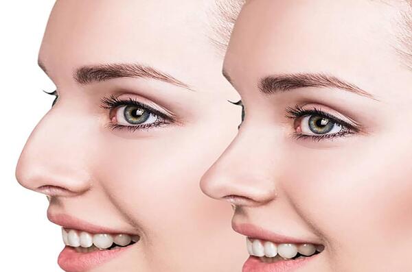 عکس خدیجه ابراهیمی