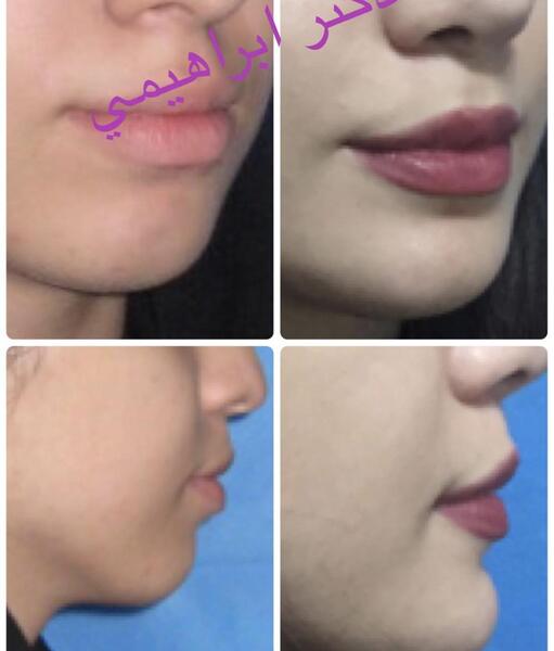 عکس خدیجه ابراهیمی