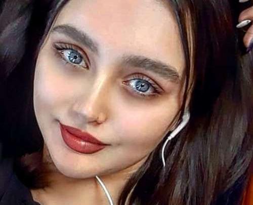 عکس شیرین محبت قبل از عمل