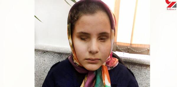 عکس چشم کور شده