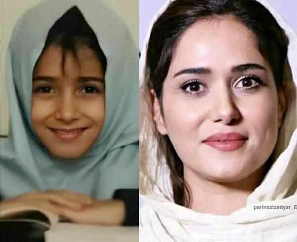 عکس پریناز ایزدیار قبل از عمل بینی