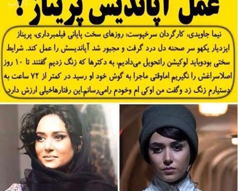 عکس پریناز ایزدیار قبل از عمل بینی