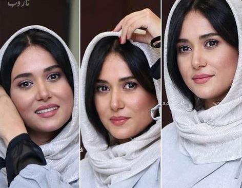 عکس پریناز ایزدیار قبل از عمل بینی