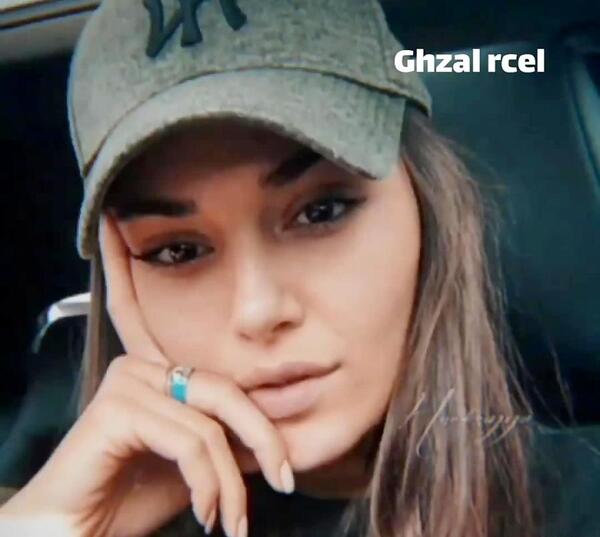 عکس قبل عمل هانده ارچل