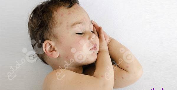 عکس نوزاد حشرات