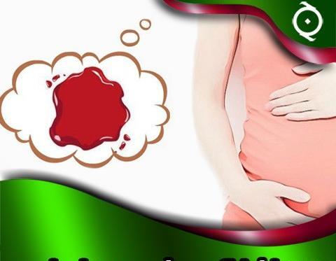 عکس لکه بینی طبیعی در بارداری