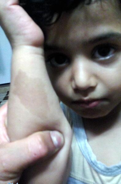 عکس لکه ماه گرفتگی
