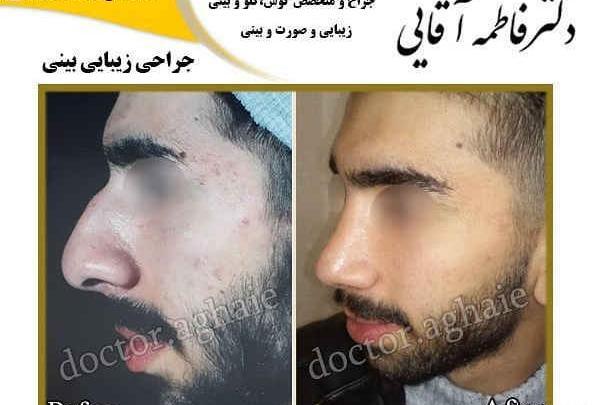 عکس فاطمه آقایی