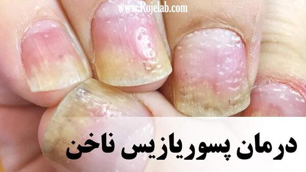 عکس صدف ناخن