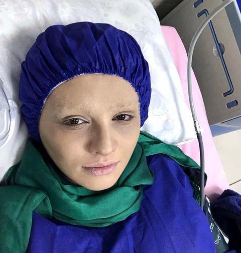 عکس مرد روی تخت بیمارستان
