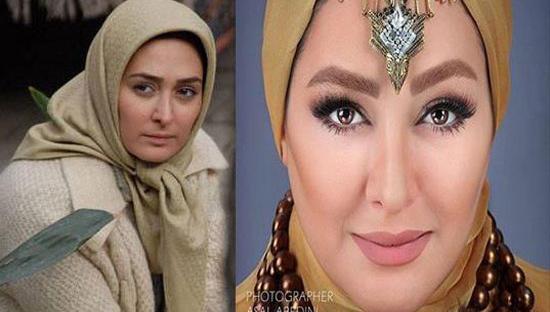 عکس خاطره حاتمی قبل و بعد از عمل بینی