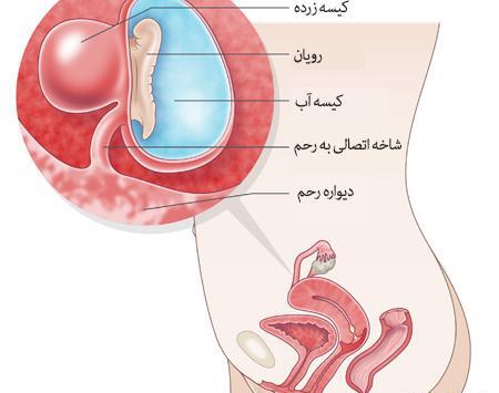 عکس لکه بینی در هفته پنجم بارداری
