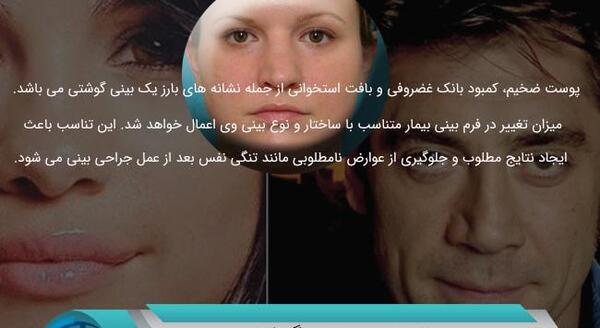 عکس شیرین عبدالوهاب قبل از عمل