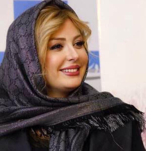 عکس نیوشا ضیغمی قبل از عمل بینی