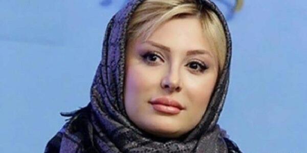 عکس نیوشا ضیغمی قبل از عمل بینی