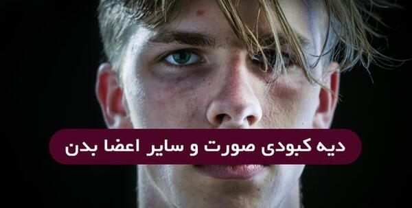 عکس کبودی زیر گلو