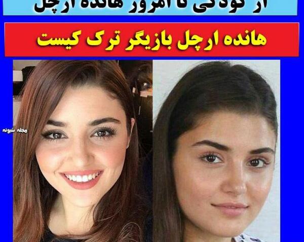عکس کودکی هانده ارچل