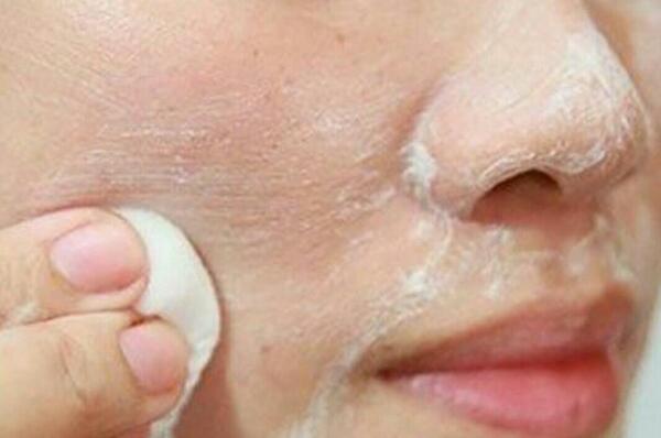 عکس سفیداب