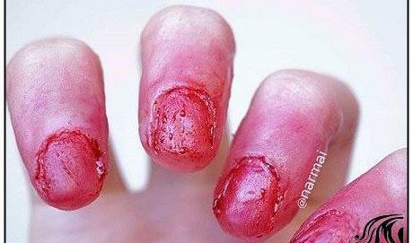 عکس ترسناک ناخن