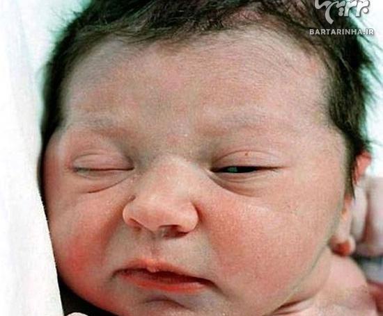 عکس نوزاد متولد شده