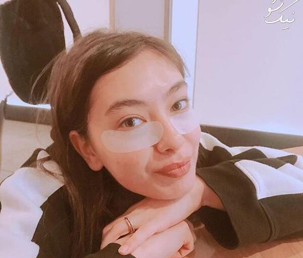 عکس نسلیهان اتاگول قبل از عمل زیبایی