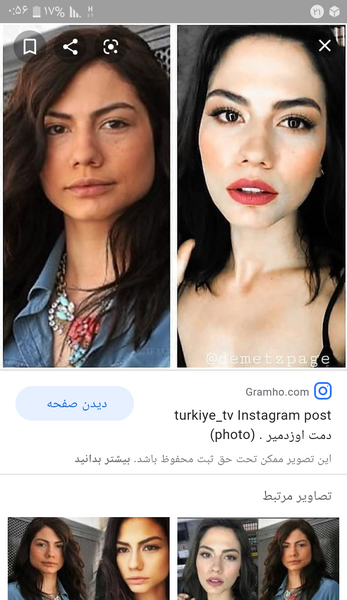 عکس دمت اوزدمیر قبل از عمل