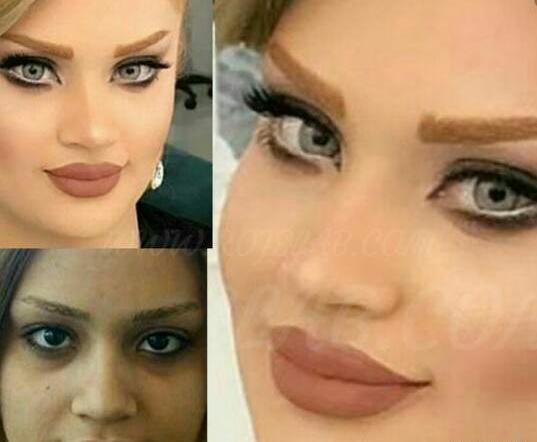 عکس قبل و بعد صورت