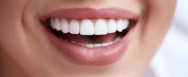 عکس لبخند کامپوزیت