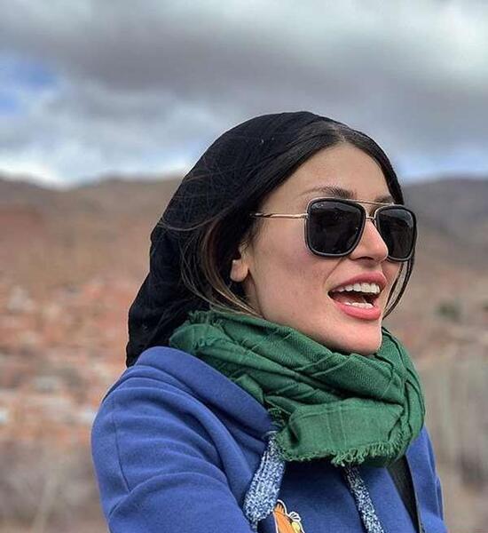 عکس شیوا طاهری قبل از عمل