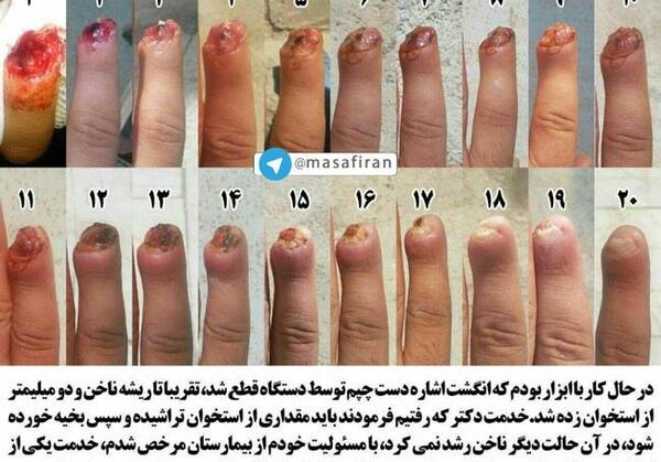 عکس طحال گاو