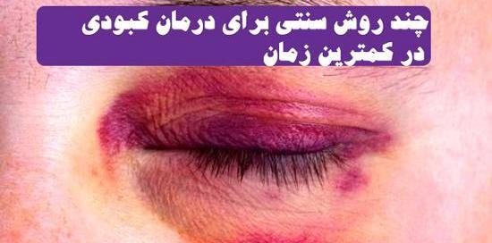 عکس نوشته کبودی