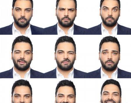 عکس قبل جراحی احسان علیخانی