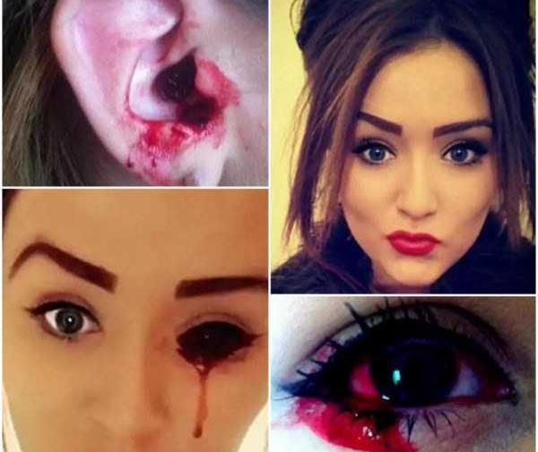 عکس چشم خونی دختر