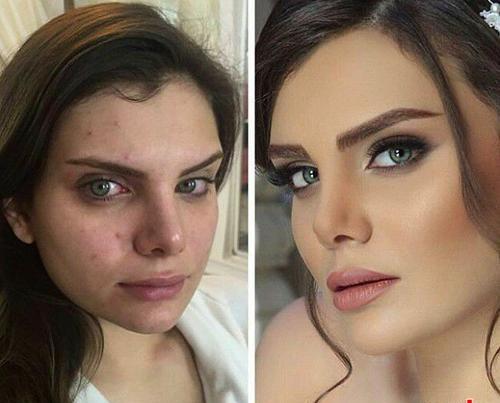 عکس صورت قبل و بعد ارایش
