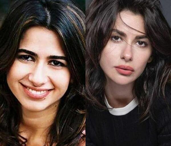 عکس قبل از عمل شاهیکا