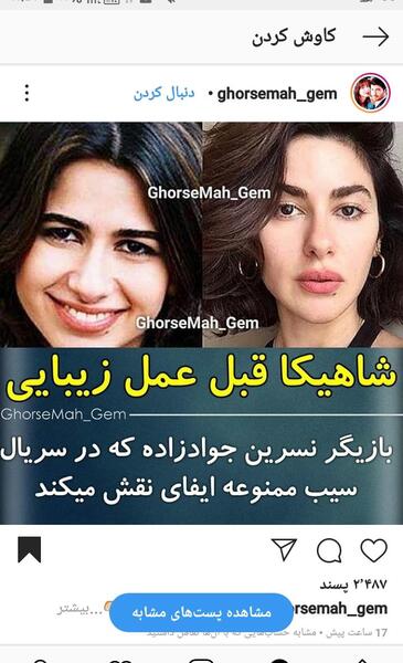 عکس قبل از عمل شاهیکا